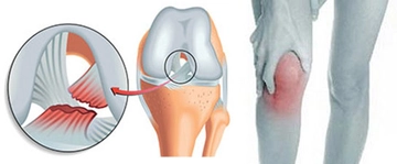 Keten Tohumu Yoğurt ile Kullanımı ve Faydaları Nelerdir?